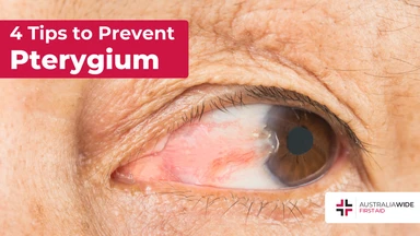 Prevent pterygium article header – First Aid Article in Hunter Region